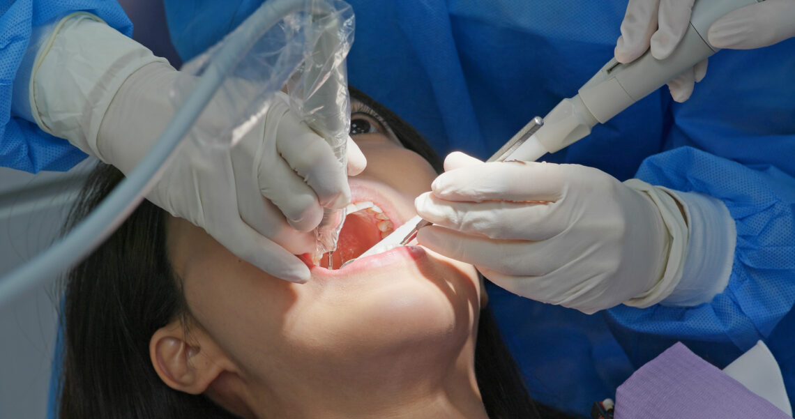 Cuidados a seguir después de una cirugía de extracción dental